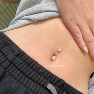 Belly Button Piercing Keloid: