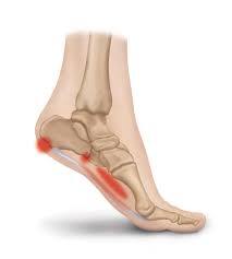 is heel pain a sign of cancer