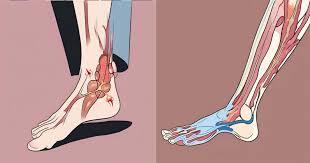 is heel pain a sign of cancer