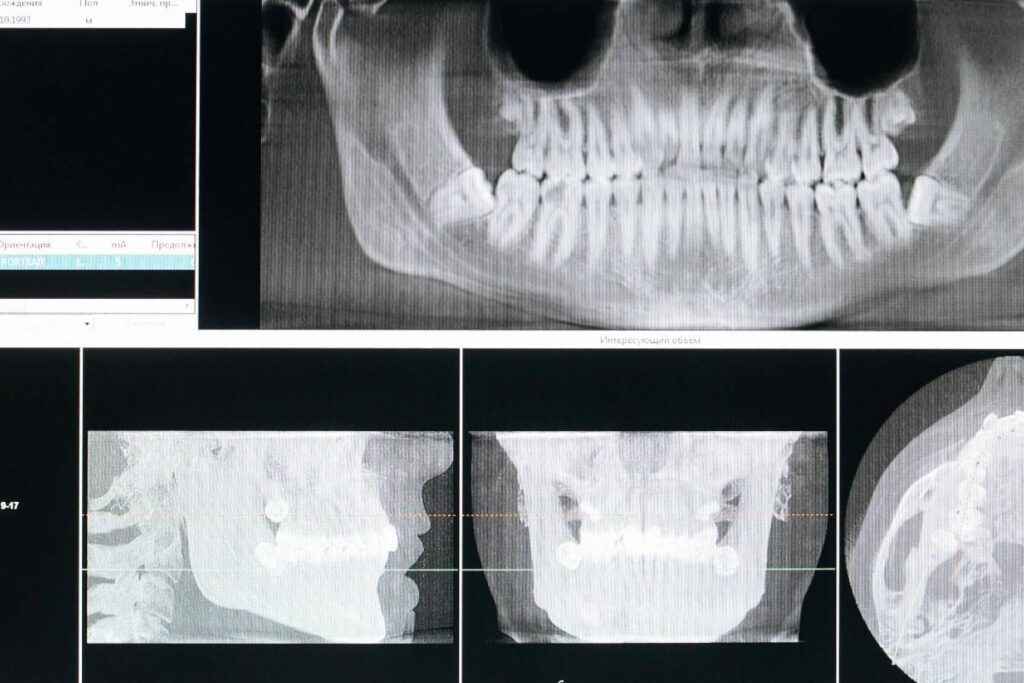 Signs That You Need a Dental Cleaning