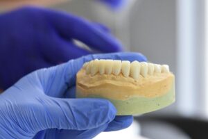 Mini Dental Implants Price